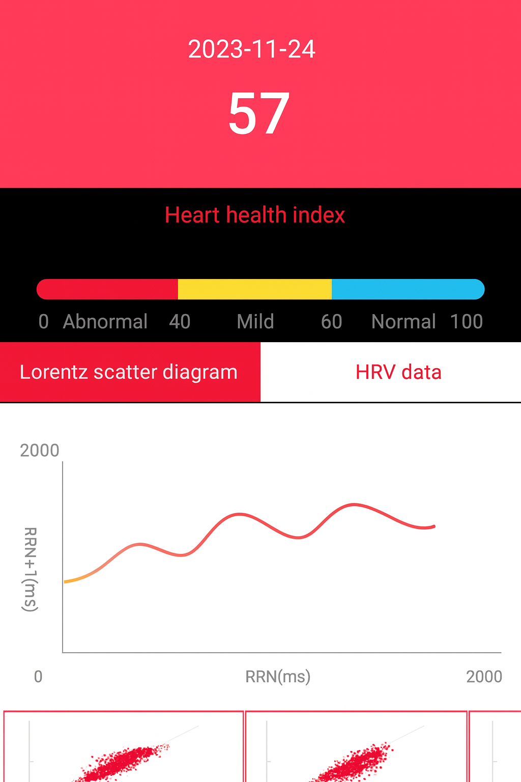 Life Watch Pro HRV monitoring dashboard with heart rate variability graph and Lorenz plot.